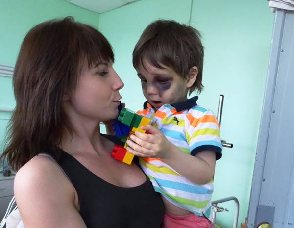 Откуда у ребёнка синяки и ушибы, выясняют мама и полиция