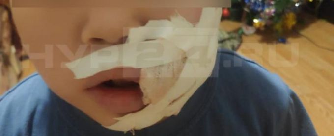 По факту нападение собаки на ребенка в Сеяхе следователи проводят проверку
