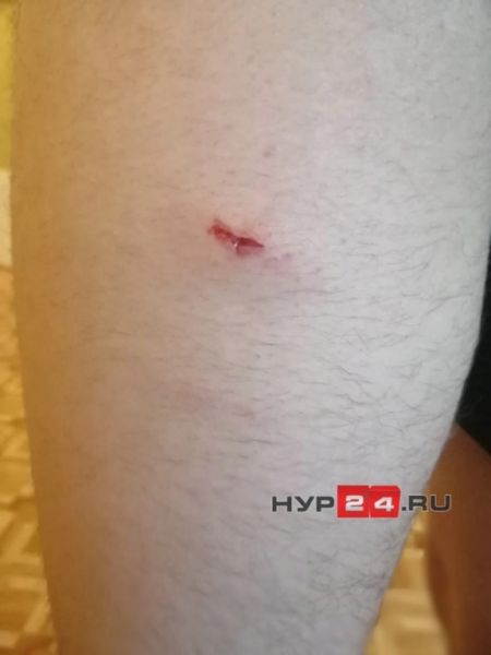 В Лабытнанги бездомная собака укусила подростка