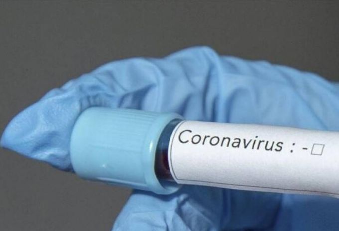 Первый случай COVID-19 выявлен в Ноябрьске – у медработника